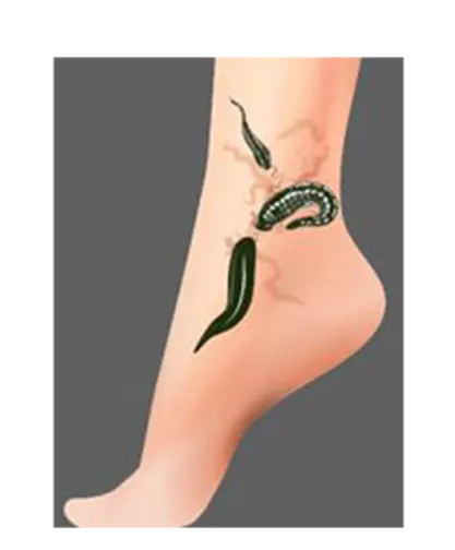 Kerala Panchakarma Ashram